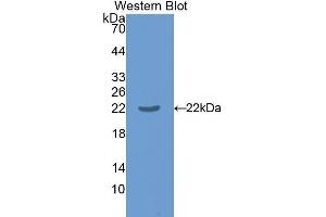 Western Blotting (WB) image for anti-Interleukin 17 Receptor B (IL17RB) (AA 166-354) antibody (ABIN1859362) (IL17 Receptor B antibody  (AA 166-354))