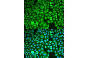 Immunofluorescence analysis of A549 cell using ETS1 antibody.