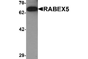 Western blot analysis of RABEX5 in rat brain tissue lysate with RABEX5 antibody at 1 µg/mL. (RABGEF1 antibody  (C-Term))
