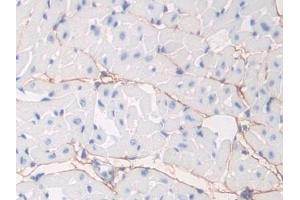 Detection of FBN1 in Mouse Heart Tissue using Polyclonal Antibody to Fibrillin 1 (FBN1) (Fibrillin 1 antibody  (AA 959-1145))