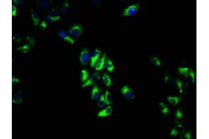Immunofluorescence staining of Hela cells with ABIN7175204 at 1:66, counter-stained with DAPI. (VTCN1 antibody  (AA 26-258))