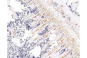 Immunohistochemistry analysis of paraffin-embedded rat bone using COL2A1 Monoclonal Antibody at dilution of 1:300. (COL2A1 antibody)