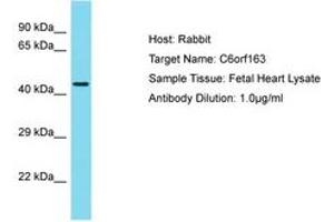 Image no. 1 for anti-Chromosome 6 Open Reading Frame 163 (C6ORF163) (AA 173-222) antibody (ABIN6750773) (C6ORF163 antibody  (AA 173-222))