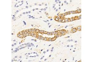 Immunohistochemistry analysis of paraffin-embedded human kidney using,SPTBN2 (ABIN7075698) at dilution of 1: 2000 (Spectrin, Beta, Non-erythrocytic 2 (SPTBN2) antibody)