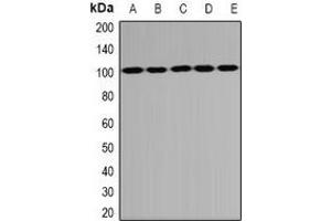 Western blot analysis of PSD95 expression in U87 (A), NIH3T3 (B), mouse thymus (C), rat brain (D), rat liver (E) whole cell lysates. (DLG4 antibody)