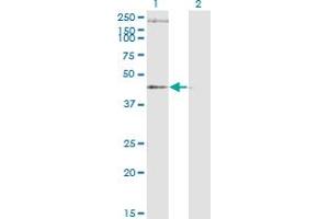 Western Blot analysis of STEAP1 expression in transfected 293T cell line by STEAP1 monoclonal antibody (M01A), clone 4F6-1F3. (STEAP1 antibody  (AA 1-339))