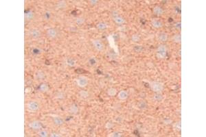 IHC-P analysis of Rat Tissue, with DAB staining. (Lymphocyte Function Associated Antigen 2 (AA 27-203) antibody)