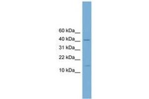 Image no. 1 for anti-Pre-B-Cell Leukemia Homeobox 4 (PBX4) (N-Term) antibody (ABIN6744610) (PBX4 antibody  (N-Term))