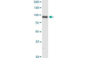 PLOD2 MaxPab rabbit polyclonal antibody. (PLOD2 antibody  (AA 1-758))