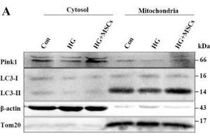 MSCs mitigate HG-induced inhibition of mitophagy through up-regulation of Pink1. (beta Actin antibody  (AA 1-375))