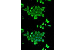 Immunofluorescence analysis of U2OS cell using PHPT1 antibody. (PHPT1 antibody)