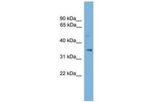 Image no. 1 for anti-Solute Carrier Family 25 (Mitochondrial Thiamine Pyrophosphate Carrier), Member 19 (SLC25A19) (AA 107-156) antibody (ABIN6744760) (SLC25A19 antibody  (AA 107-156))