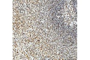 IHC analysis of SFPQ using anti-SFPQ antibody (ABIN7603089).
