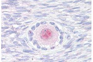 TM9SF4 Antikörper  (Internal Region)