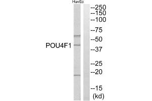 Western blot analysis of extracts from HuvEc cells, using POU4F1 antibody. (POU4F1 antibody  (Internal Region))