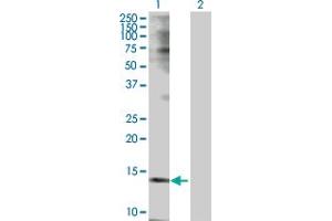 Western Blot analysis of TSPO expression in transfected 293T cell line by TSPO MaxPab polyclonal antibody. (TSPO antibody  (AA 1-169))
