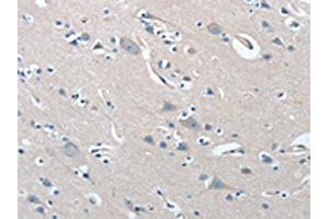 The image on the left is immunohistochemistry of paraffin-embedded Human brain tissue using ABIN7192019(PRKX Antibody) at dilution 1/15, on the right is treated with synthetic peptide. (PRKX antibody)
