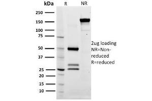 SDS-PAGE Analysis Purified CD79a Mouse Monoclonal Antibody (ZL7-4). (CD79a antibody)