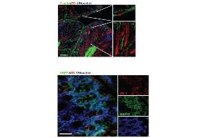 Detection of colonic tight junction proteins and heat shock proteins (HSPs) in response to Limosilactobacillus reuteri in healthy young mice. (TJP1 antibody)