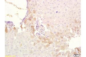 Immunohistochemistry (IHC) image for anti-ATP-Binding Cassette, Sub-Family B (MDR/TAP), Member 6 (ABCB6) (AA 401-520) antibody (ABIN673614)