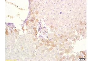 Formalin-fixed and paraffin embedded rat liver tissue labeled with Anti-ABCB6 Polyclonal Antibody, Unconjugated at 1:200, followed by conjugation to the secondary antibody and DAB staining