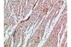 Immunohistochemical analysis of paraffin-embedded Human-heart, antibody was diluted at 1:100 (MIA antibody  (AA 90-131))