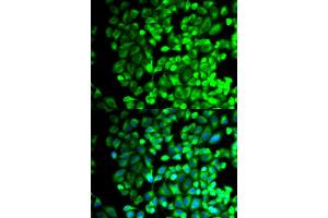 Immunofluorescence (IF) image for anti-thromboxane A Synthase 1 (Platelet) (TBXAS1) antibody (ABIN1875427)