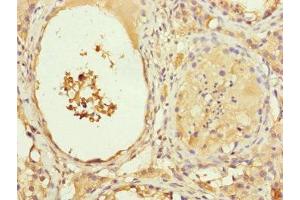Immunohistochemistry of paraffin-embedded human testis tissue using ABIN7151076 at dilution of 1:100 (MYLIP antibody  (AA 266-445))