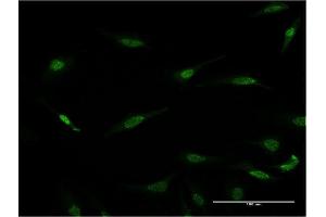 Immunofluorescence of monoclonal antibody to RAX on HeLa cell. (RAX antibody  (AA 253-346))