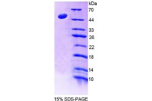 SDS-PAGE (SDS) image for Ladinin 1 (LAD1) (AA 1-192) protein (His tag,GST tag) (ABIN4989352) (Ladinin 1 Protein (LAD1) (AA 1-192) (His tag,GST tag))