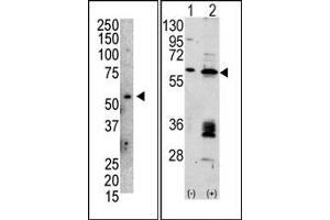 Image no. 1 for anti-Mdm2, p53 E3 Ubiquitin Protein Ligase Homolog (Mouse) (MDM2) (C-Term) antibody (ABIN356777) (MDM2 antibody  (C-Term))