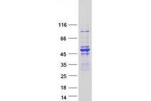 Validation with Western Blot