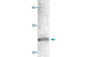 Western blot of MCF-7 cell extracts with CBX1 polyclonal antibody  at 1000 fold dilution. (CBX1 antibody  (AA 176-185))