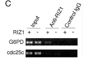 ChIP analysis of estrogen target genes. (PRDM2 antibody  (AA 1-347))