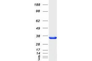 Validation with Western Blot (SULT4A1 Protein (Myc-DYKDDDDK Tag))