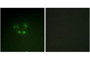 Immunofluorescence analysis of A549 cells, using Nibrin (Ab-278) Antibody.