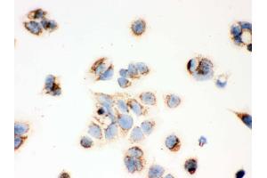 Immunohistochemistry (IHC) image for anti-Hydroxysteroid (17-Beta) Dehydrogenase 10 (HSD17B10) (AA 48-261) antibody (ABIN3042460)