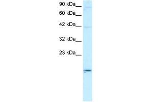 ApoBEC3G antibody used at 2 ug/ml to detect target protein. (APOBEC3G antibody  (N-Term))