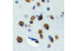 Immunohistochemical analysis of RFWD3 staining in human brain formalin fixed paraffin embedded tissue section. (RFWD3 antibody  (Center))