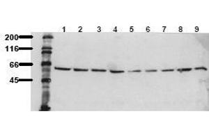 Western Blotting (WB) image for anti-V-Akt Murine Thymoma Viral Oncogene Homolog 1 (AKT1) (C-Term), (Ser473) antibody (ABIN126854) (AKT1 antibody  (C-Term, Ser473))