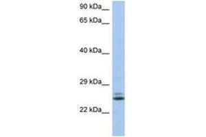 Image no. 1 for anti-RAB15, Member RAS Onocogene Family (RAB15) (AA 35-84) antibody (ABIN6743923) (RAB15 antibody  (AA 35-84))