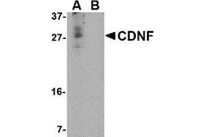 Western Blotting (WB) image for anti-Cerebral Dopamine Neurotrophic Factor (CDNF) (N-Term) antibody (ABIN1031315) (CDNF antibody  (N-Term))