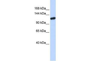 WB Suggested Anti-PIWIL4 Antibody Titration: 0. (PIWIL4 antibody  (N-Term))