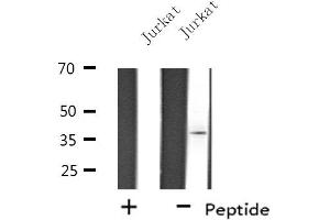 Western blot analysis of extracts from Jurkat cells, using OSR2 antibody. (OSR2 antibody  (Internal Region))