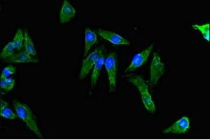 Immunofluorescent analysis of Hela cells using ABIN7143140 at dilution of 1:100 and Alexa Fluor 488-congugated AffiniPure Goat Anti-Rabbit IgG(H+L) (Actin, gamma 1 antibody  (AA 13-166))