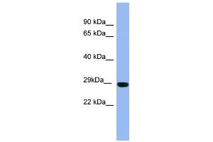 WB Suggested Anti-RAB1A Antibody Titration: 0. (RAB1A antibody  (Middle Region))