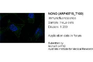 Image no. 2 for anti-Non-POU Domain Containing, Octamer-Binding (NONO) (N-Term) antibody (ABIN2779027) (NONO antibody  (N-Term))