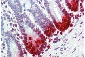 Human Small Intestine (formalin-fixed, paraffin-embedded) stained with DEFA5 antibody ABIN396940 at 10 ug/ml followed by biotinylated anti-mouse IgG secondary antibody ABIN481714, alkaline phosphatase-streptavidin and chromogen. (DEFA5 antibody)
