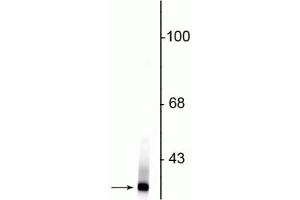 Western blot of rat kidney lysate showing specific immunolabeling of the ~21 kDa Park7 protein. (PARK7/DJ1 antibody)