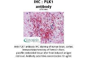 Image no. 1 for anti-Polo-Like Kinase 1 (PLK1) (AA 161-440) antibody (ABIN1738157) (PLK1 antibody  (AA 161-440))